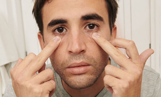 Ojeras: Causas y Tratamientos Efectivos para hombres
